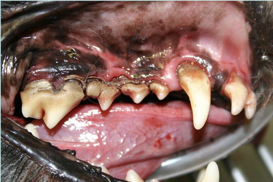 <p>Periodontal Disease</p>
