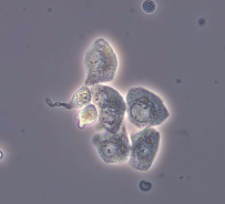 <p>Renal Tubular Epithelial Cells</p>