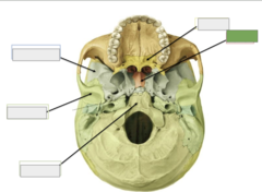 <p>Inferior view: this is the</p>