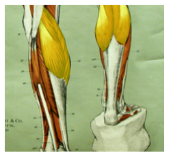 <p>What is the highlighted muscle? What is its action?</p>