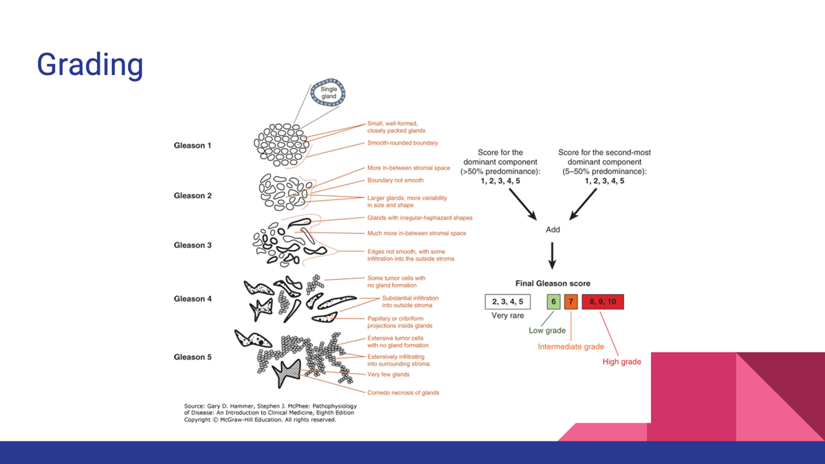 <p><span>●<strong>Grade</strong></span></p><p><span>●Describes the appearance and behavior of the tumor cells</span></p><p><span>●Determined by pathologist based on well-defined criteria developed for the tissue analysis of each type of cancer</span></p><p><span>●Criteria involved:</span></p><p><span>○Differentiation of a tumor</span></p><p><span>○Quality of nuclear chromatin</span></p><p><span>○Quantitative assessment of proliferative rate (mitoses)</span></p><p></p><p></p>