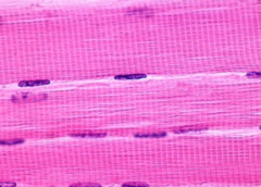<p>Muscle tissue. Long cells with striations. Nuclei pushed to edges of cells</p>