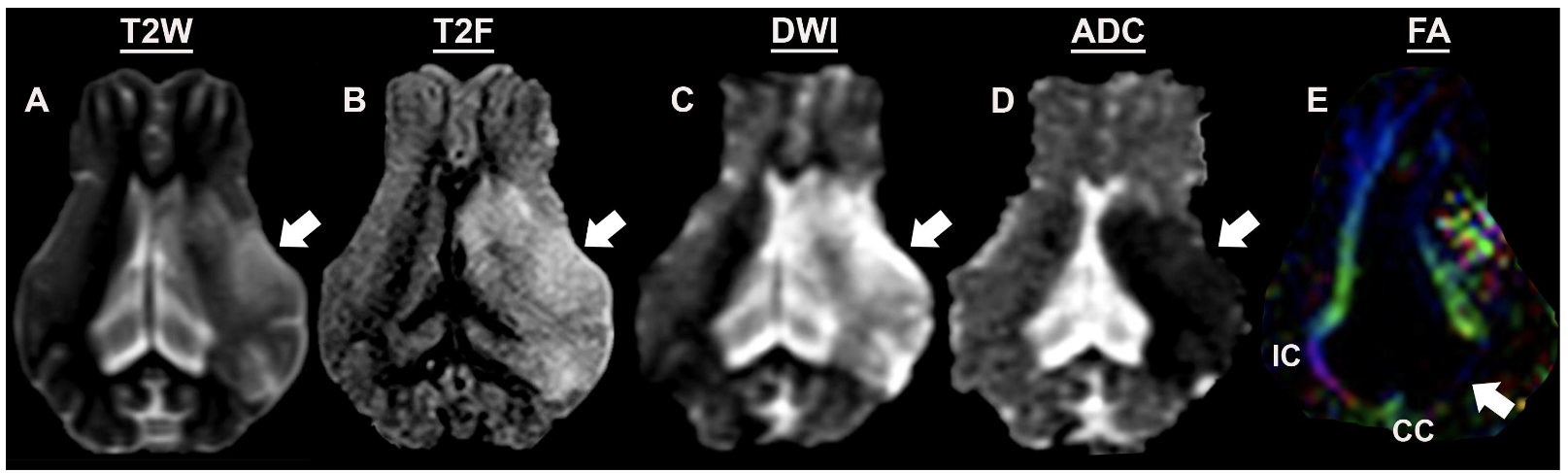 <p>what is this an mri of</p>
