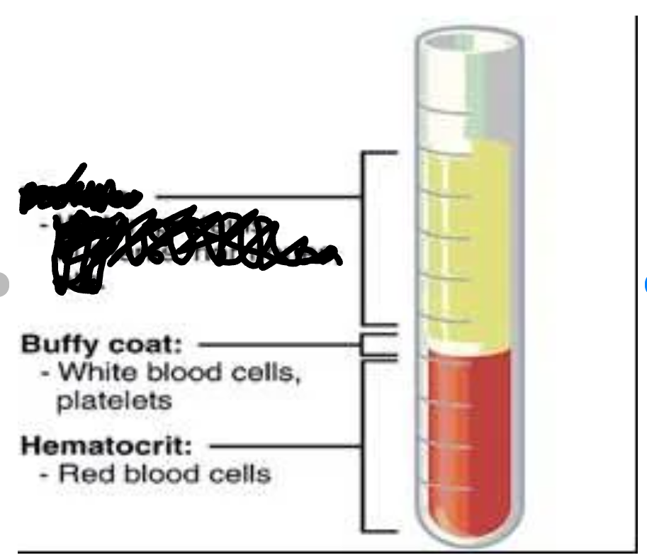 <p>Identify the labeled component:</p>