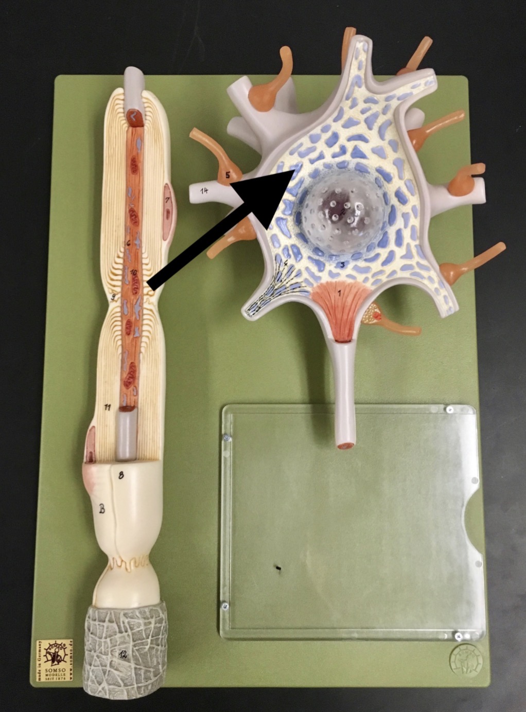 <p>What is the arrow pointing to?</p>