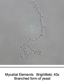 <p>Mycelial elements</p>