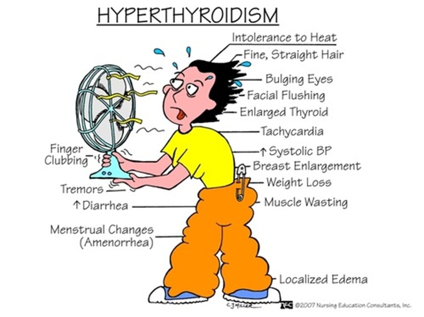<p>(graves disease)</p><p>-only affects women, autoimmune</p><p>-body produces antibodies (normally fight infection), but this AB's instead will go to the thyroid and will mimic the cascade. They tell the thyroid to produce more thyroid hormone, even when negative feedback is taking place</p><p>-Sx: exophalmos (bulging of the eyes caused by inflammation from cell mediators), toxic goiter, symptoms are also due to everything speeding up (hot because of increased metabolism which makes more ATP - ATP releases heat, shaky: everything is moving fast through body, weight loss: crazy fast metabolism, tachycardia, increased BP: thyroid hormone helps maintain BP</p><p>-Tx: iodine (kill part of thyroid) or surgically remove part of thyroid</p>