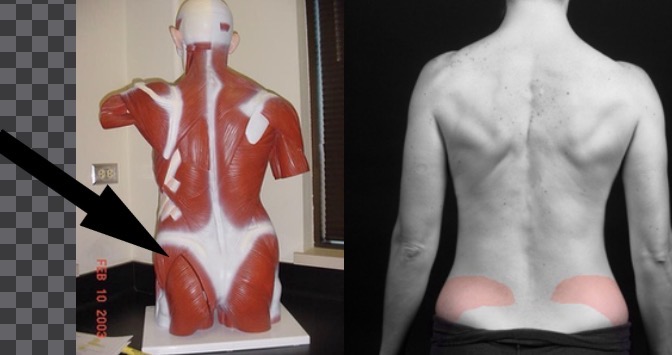 <p>What muscle is this?</p>