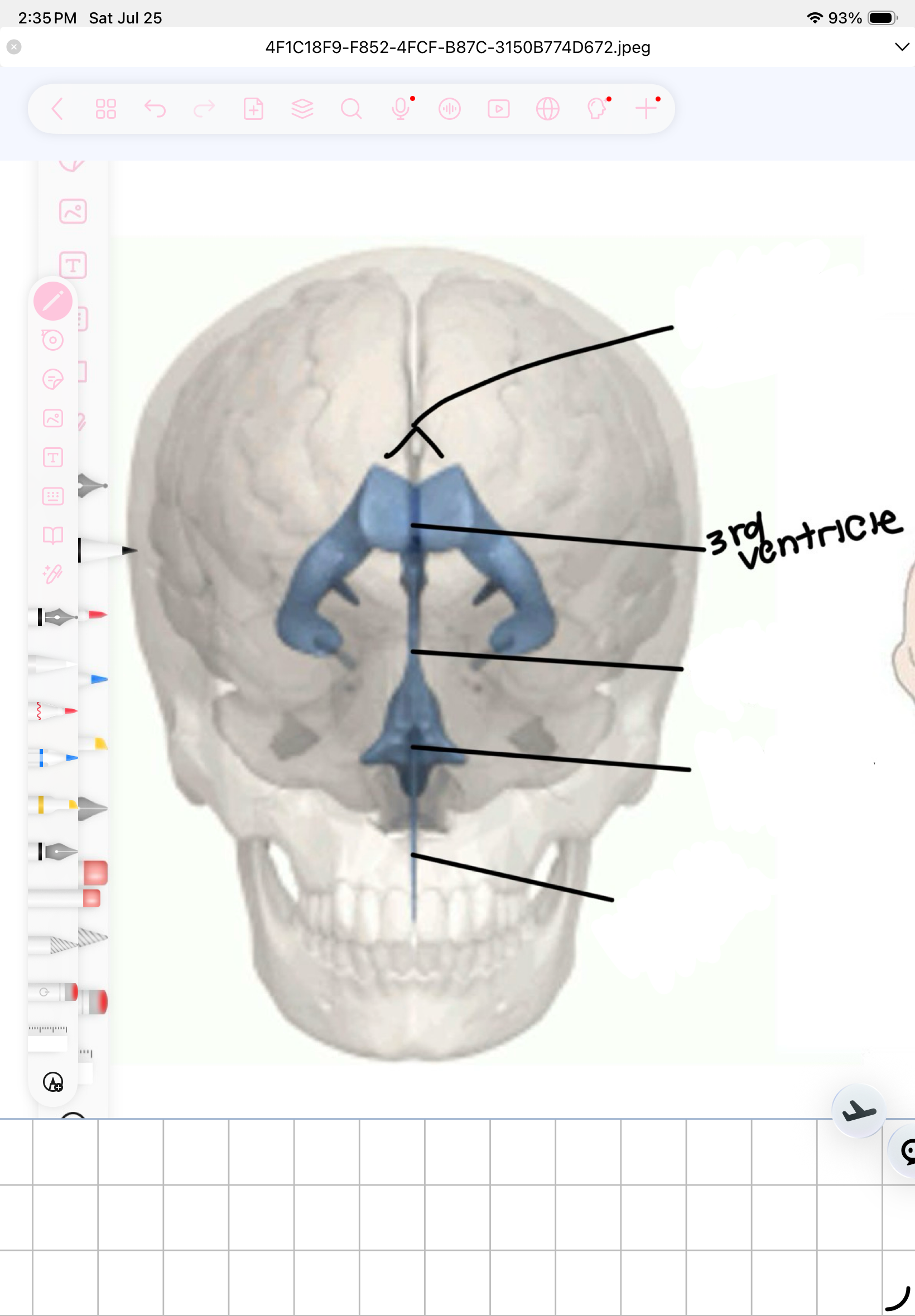 term image