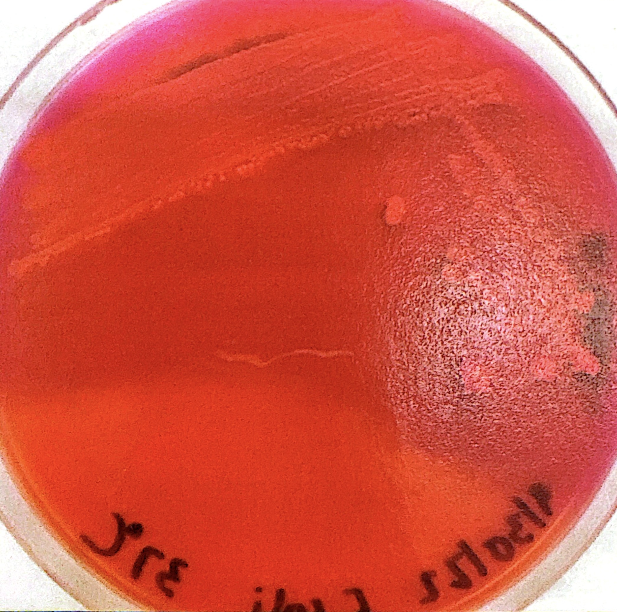 <p>red agar around colonies on MAC</p>