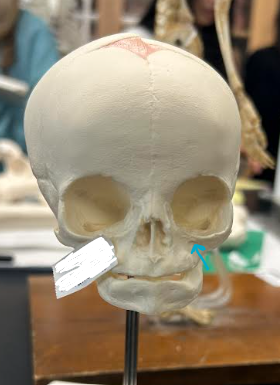 <p>ID skull hole region</p>
