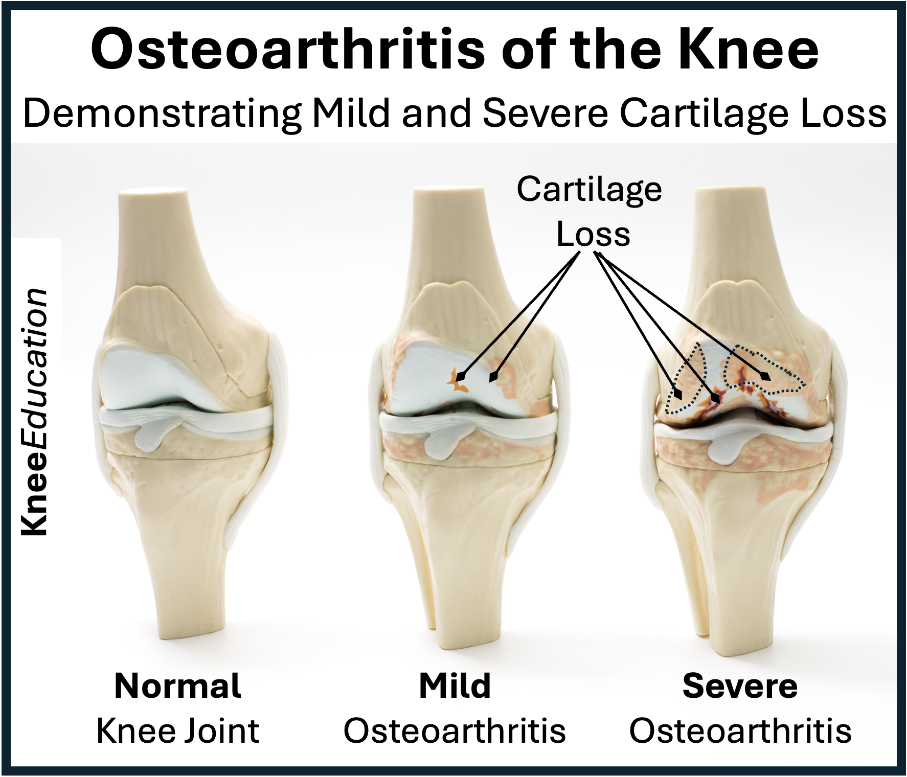 <p>What injury / condition? </p>