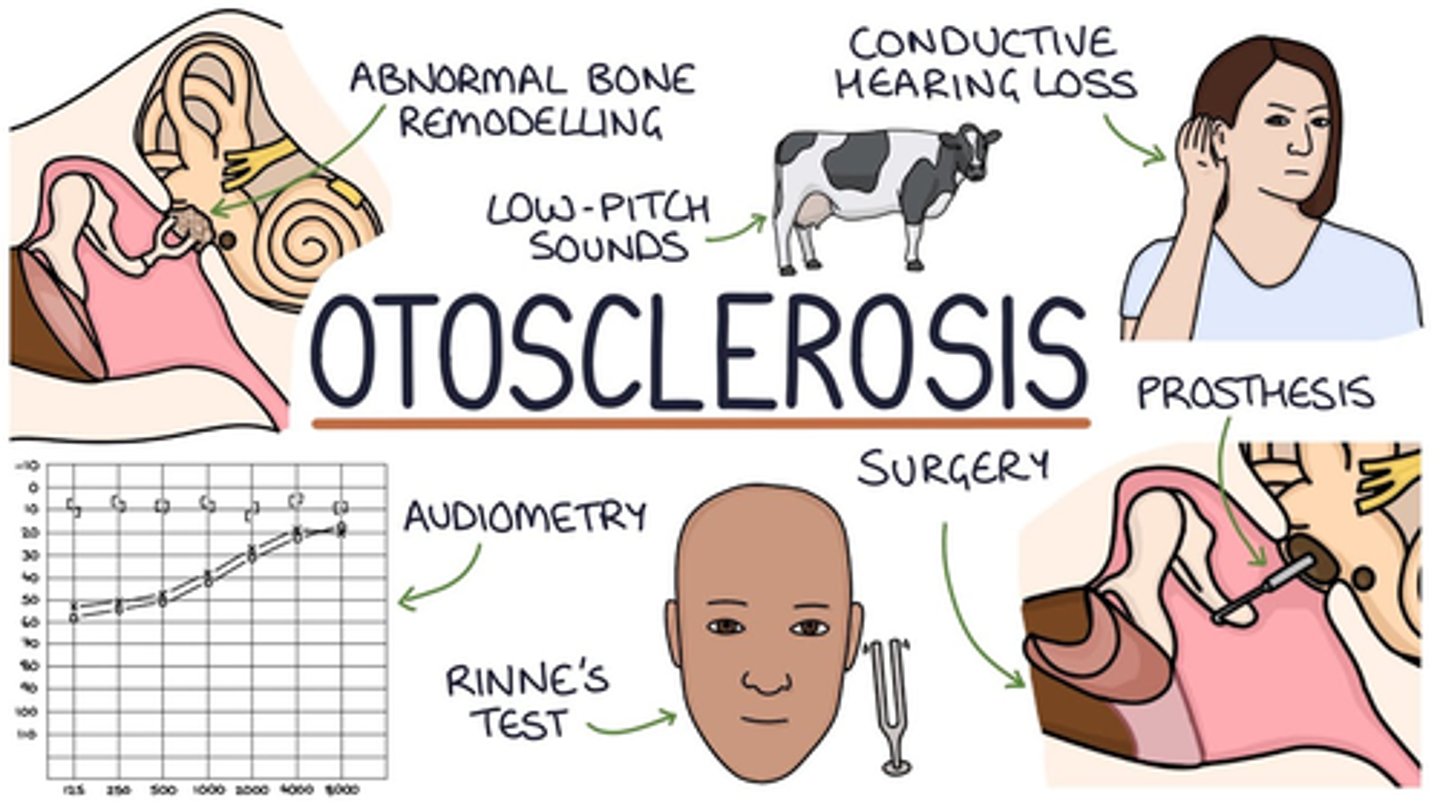 <p>D) otosclerosis</p><p>EXPLANATION</p><p>In the case of otosclerosis, there is no pain but only hearing loss.</p>