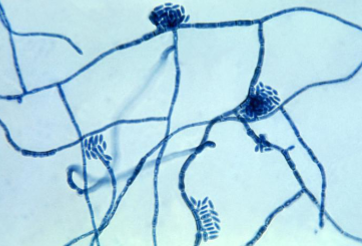 <p>ascomycete, causes tinea nigra</p>