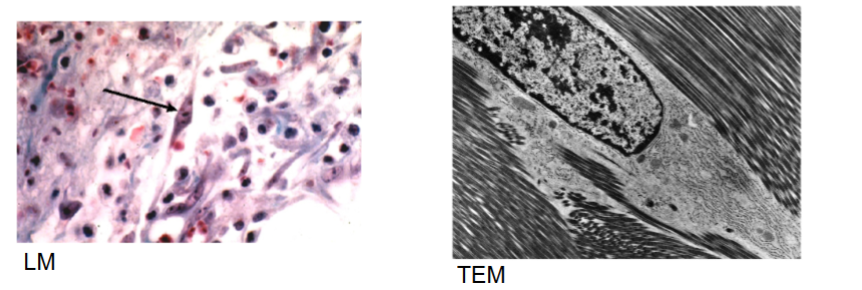 <p>principal cell of connective tissue, synthesis of ECM fibers (collagen, elastic, reticular) and ground substance, rarely divide but mitosis resumes during wound healing, not terminally differentiated</p>