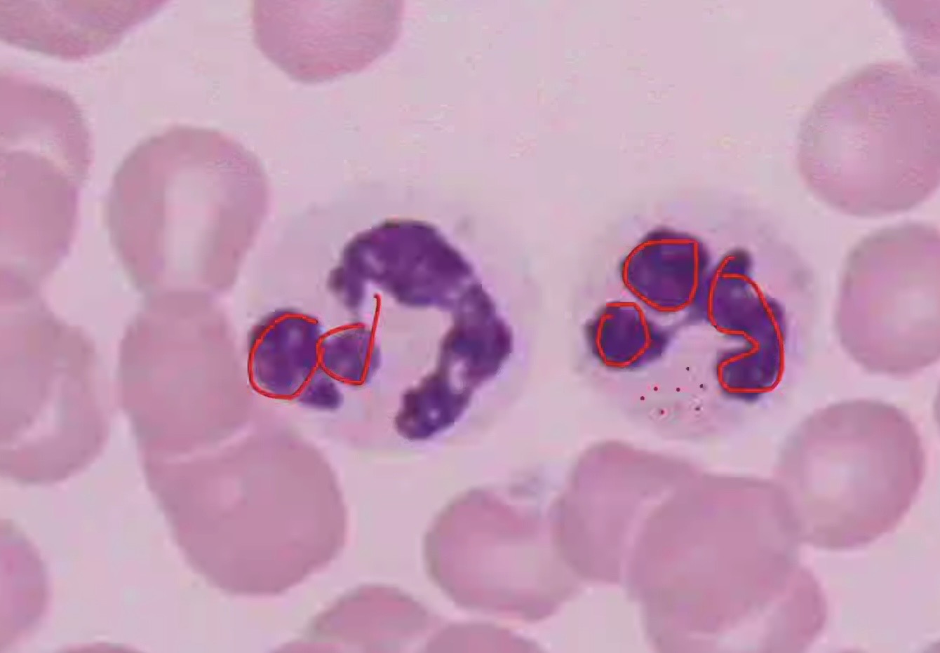 <p><span>The most abundant of the WBCs.</span></p><p><span> kill the invaders (e.g., bacteria) and then engulf the remnants by phagocytosis.</span></p>
