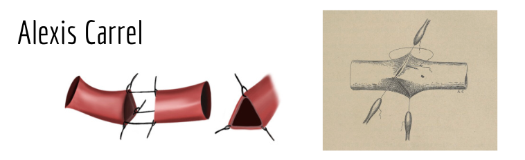 <p>alexis carrel</p><ul><li><p>considred father of modern vascular and transplantation surgery</p></li><li><p>used better needles with much finer sutoring material</p></li></ul><p>Triangulation</p><ul><li><p>hold vessel open</p></li><li><p>make three sutures and pull to create 3 flat lines = 3 separate sutures</p></li><li><p>do not penetrate the wall</p></li></ul><p><br></p>