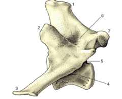 <p>This is an example of a _____ bones</p>