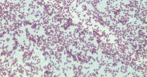 <p>Bacteria Species: </p><p>Endospore +/ - : </p><p></p>