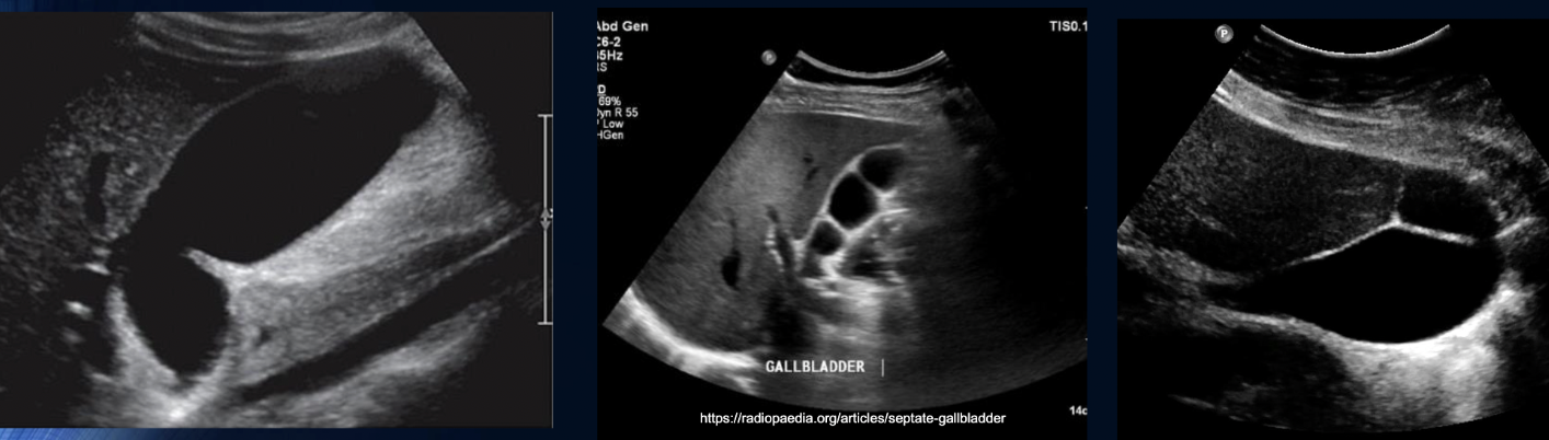 <p>are these pathology or congenital?</p>