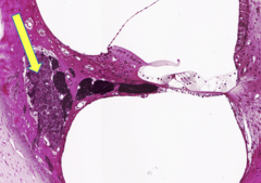 <p>identify the structure</p>