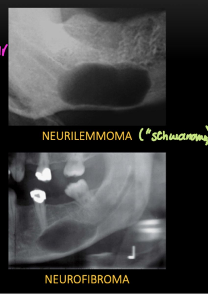 <p>in the mandibular canal</p>