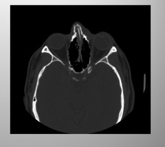 <p>CT</p>