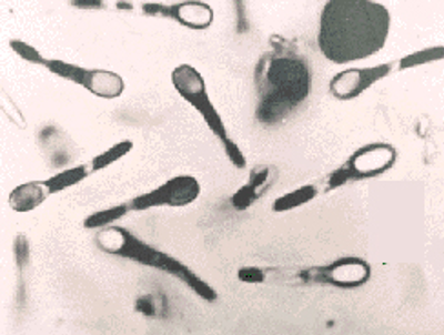 <p><span>T</span>he process by which certain bacteria produce a highly resistant, dormant structure called an endospore when environmental conditions become unfavourable, such as when nutrients are limited.</p><p class="MsoNormal"><span>Spores are very resistant to heat, radiation, desiccation, and chemical agents. They can survive for many years.</span></p><p></p>