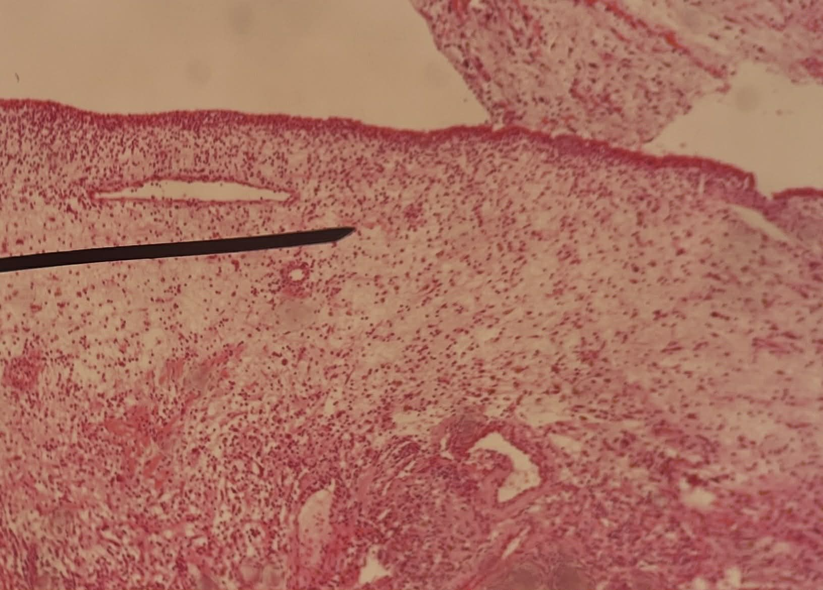 <p>Tiêu bản gì ?</p>