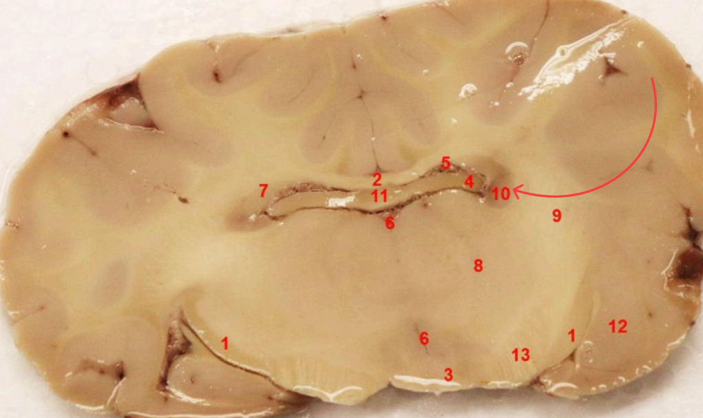 <p>what nuclei is this</p>