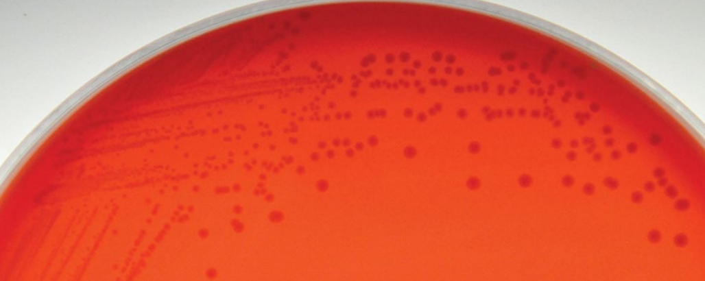 <p>test and result</p>