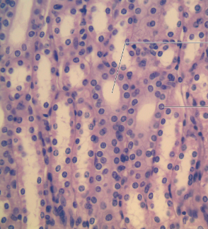 <p>picture of?</p><p></p><p></p><p>labels</p><p>lumen of renal tubule</p><p>simple cuboidal epithelium nucleus</p>