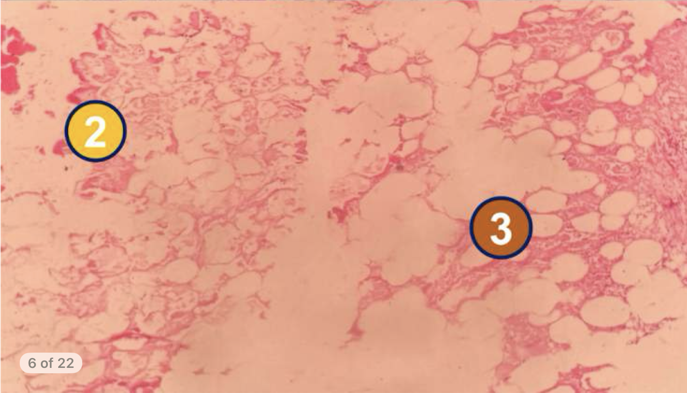 <p>diagnose and identify pointed structures</p>