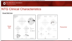 <p>What are possible VF defects that can be seen with NTG commonly?</p>