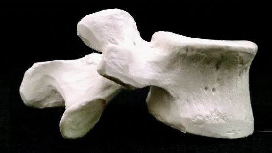 <p>what vertebrae is this?</p>