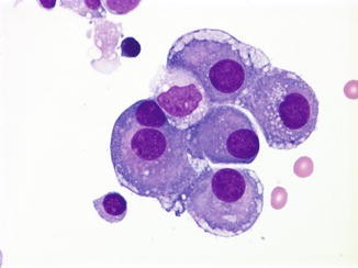 <p><strong> Halo périphérique<br>“Windows” intercellulaires<br> Binucleation possible<br>Noyau rond</strong></p>