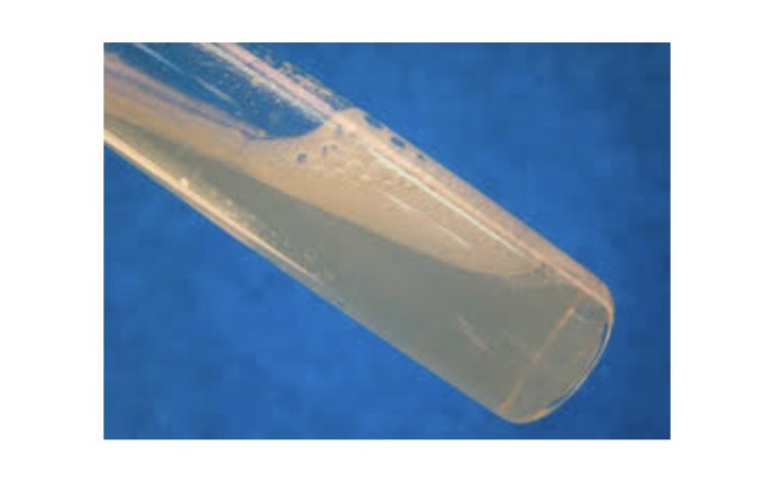<p>Catalase Test</p><p>a) Medium?</p><p>b) Substrate?</p><p>c) Enzyme?</p><p>d) Indicator/Reagent?</p><p>e) End Product?</p>