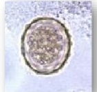 <p>Identify</p>