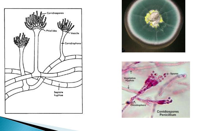 <p>What microbe is under the microscope here</p>