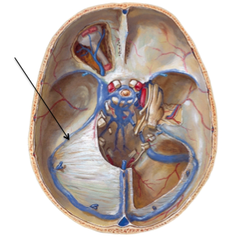 <p>- along superior edge of petrous portion of temporal bone </p><p>- transmits blood from the cavernous sinus, joins the terminal end of transverse sinus to drain into sigmoid sinus</p>