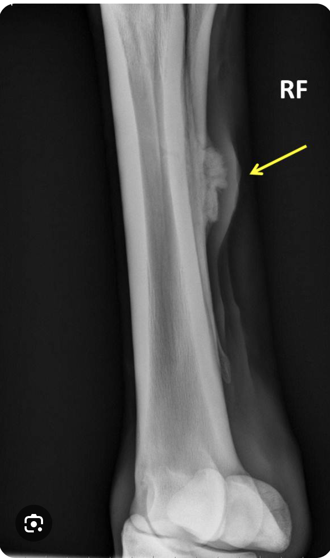 <p>Metacarpal exostosis - periostitis of the interosseus ligament between 2nd and 3rd metacarpal/tarsal</p><p>rest/ anti-inflammatories/ surgical removal</p><p></p>