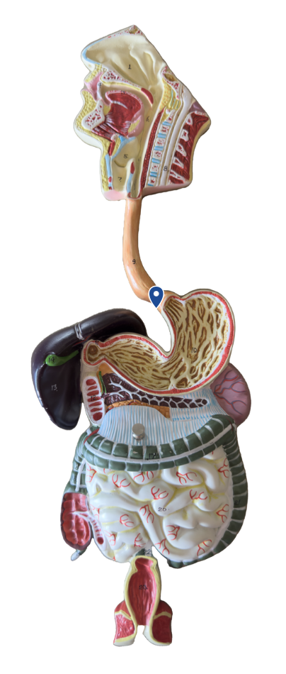 <p>Name this opening.</p>