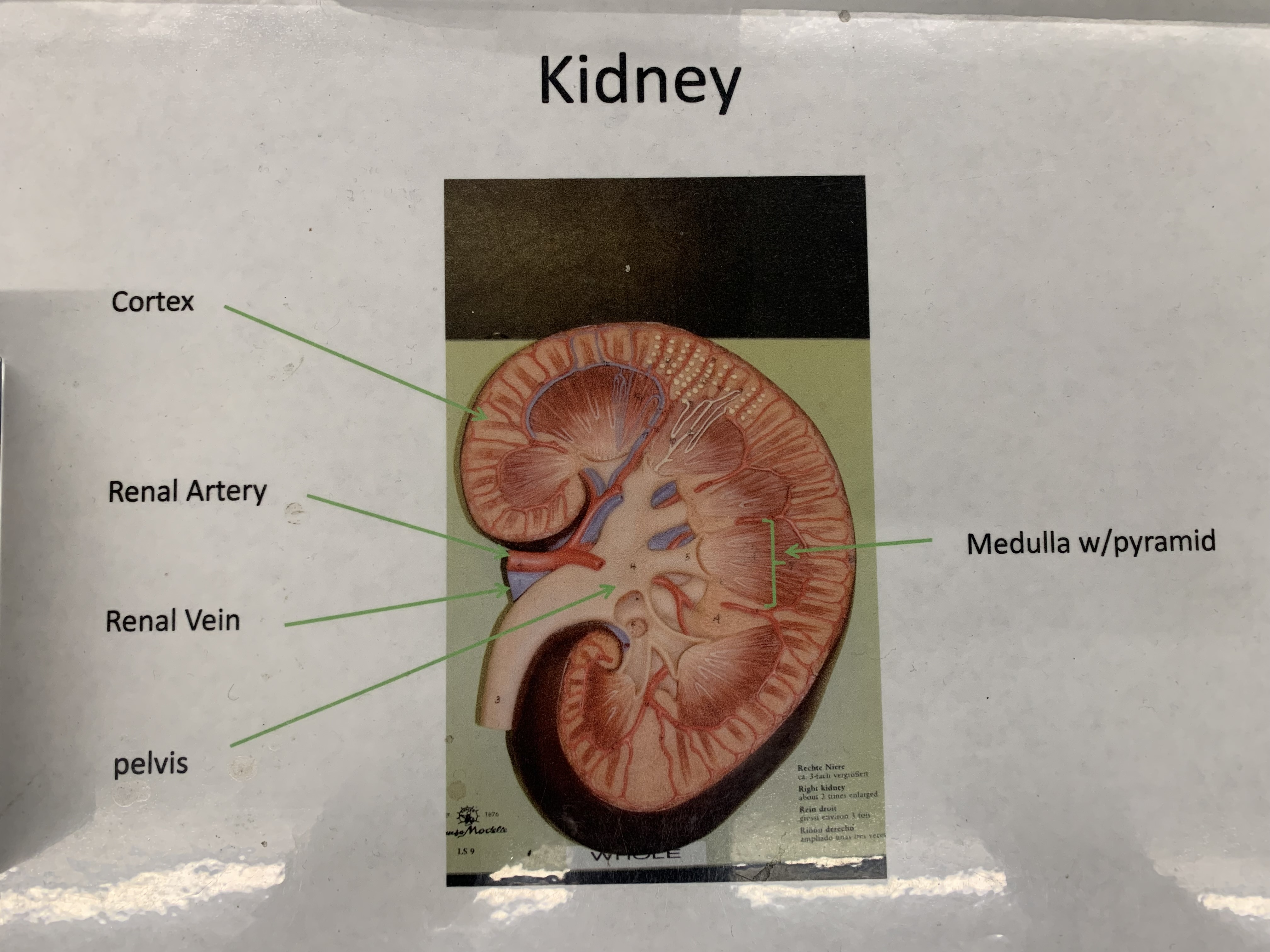 <p>1) Cortex  2) Renal Artery  3) Renal Vein  4) Pelvis  5) Medulla w/ pyramids</p>