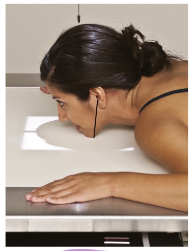 <p>name this projection and position method (CR enters the cranial parietal bone and exits at the acanthion, which is the junction of the nose and upper lip)</p>
