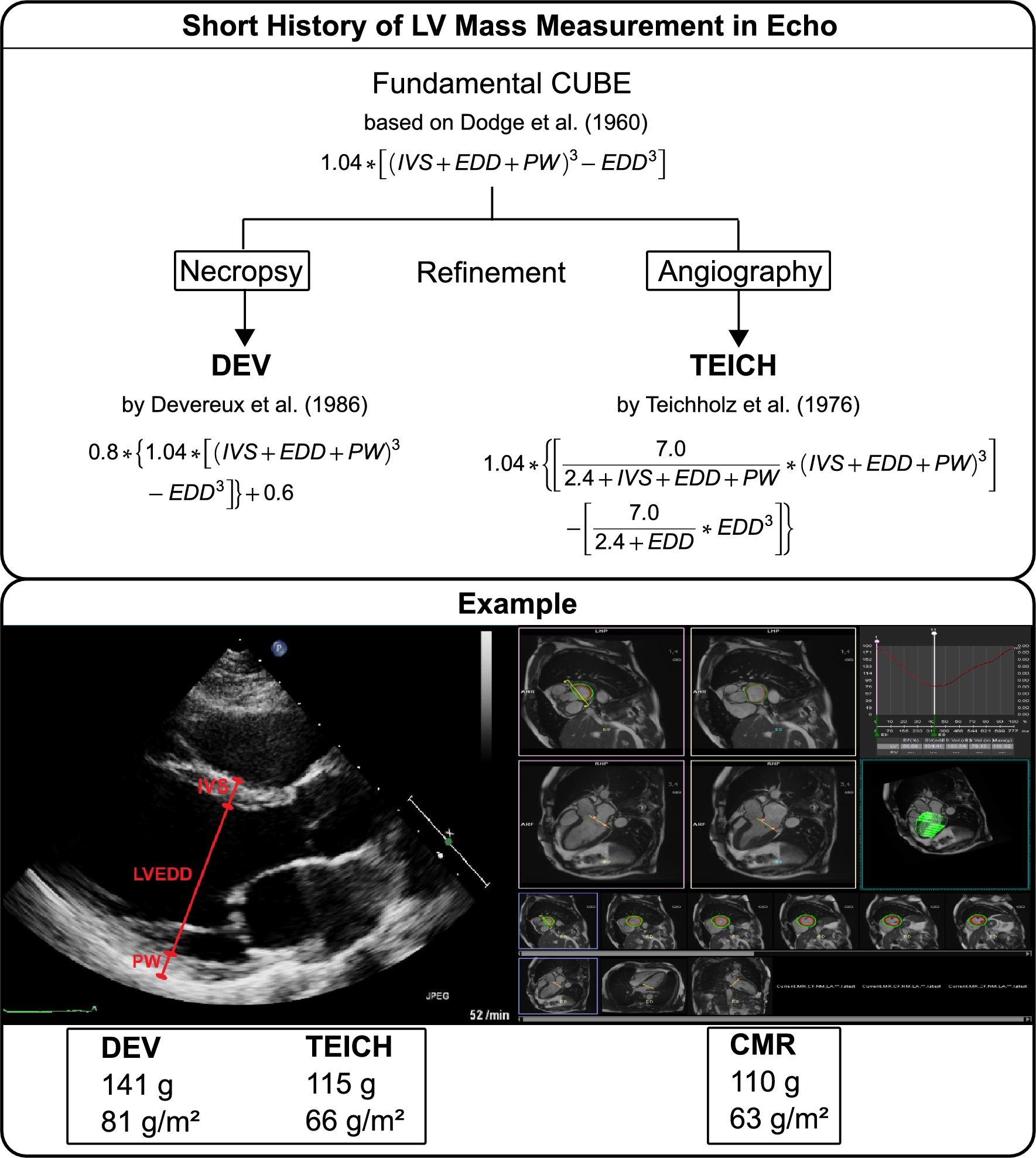 <p><span style="line-height: 0px;">Measuring the <strong>ejection fraction (EF) </strong>by:​</span></p><p class="Paragraph WhiteSpaceCollapse SCXP96916171 BCX8" style="text-align: left;"><span style="line-height: 0px;">​</span></p><ul><li><p class="Paragraph WhiteSpaceCollapse SCXP96916171 BCX8" style="text-align: left;"><span style="line-height: 0px;"><strong><u>M-mode or 2D – Teicholtzs method:</u></strong>​</span></p></li></ul><p></p>