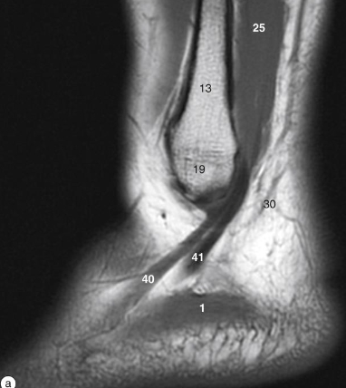 <p>What is #13?</p>