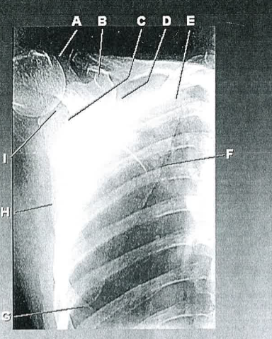 <p>E</p>