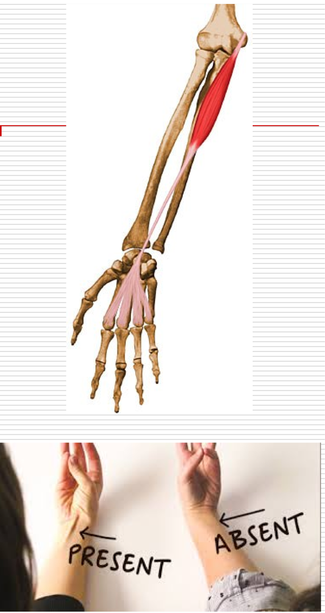 <p>Flexion of wrist </p><p>O - Medial epicondyle of humerus </p><p>I - Palmar aponeurosis and flexor retinaculum </p>