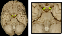<p>caudal to optic chiasm, rostral to infundibulum</p>