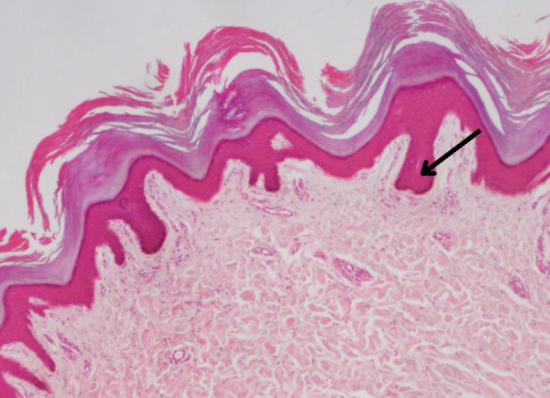 <p>what layers is this?</p>